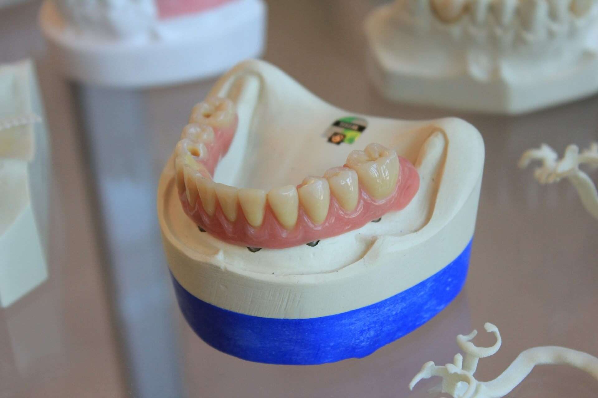 Mobilne proteze AM Dental - model proteze